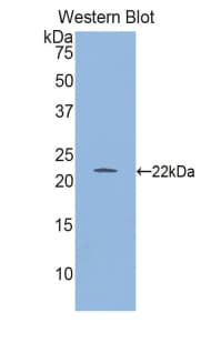 GLO1 / Glyoxalase I Antibody (aa7-182)