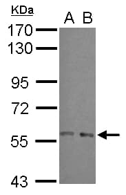 Polyclonal Rabbit anti-Human ARFGAP3 Antibody (N-Terminus, WB)
