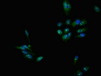 Polyclonal Rabbit anti-Human DMC1 Antibody (IHC, IF, WB)