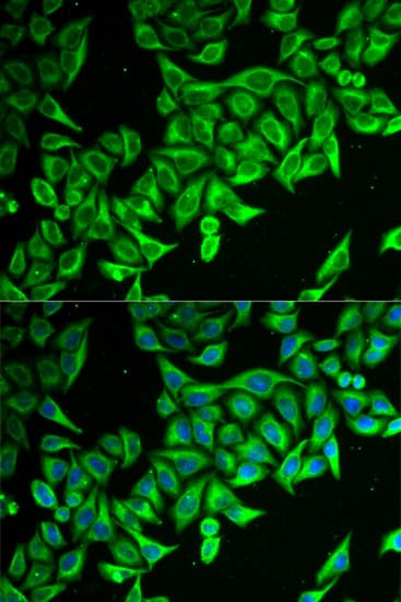 Polyclonal Rabbit anti-Human DAP Antibody (IHC, IF, WB)