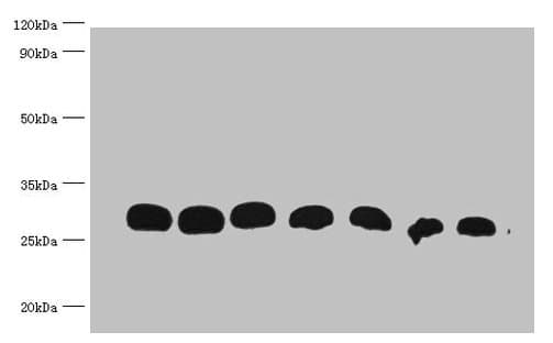 GST / Glutathione S-Transferase Antibody (clone 2A8D2)