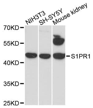 S1PR1 / EDG1 / S1P1 Antibody