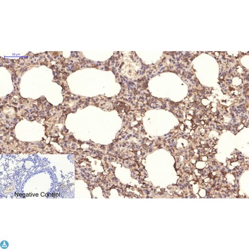 PPARD / PPAR Delta Antibody