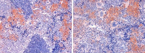 CFI / Complement Factor I Antibody