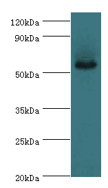 ALDH1A1 / ALDH1 Antibody (aa202-501)