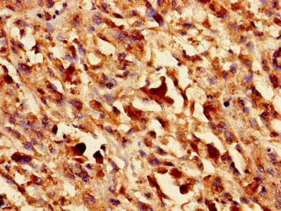 IHC-plus™ LGALS1 / Galectin 1 Antibody (aa2-135)