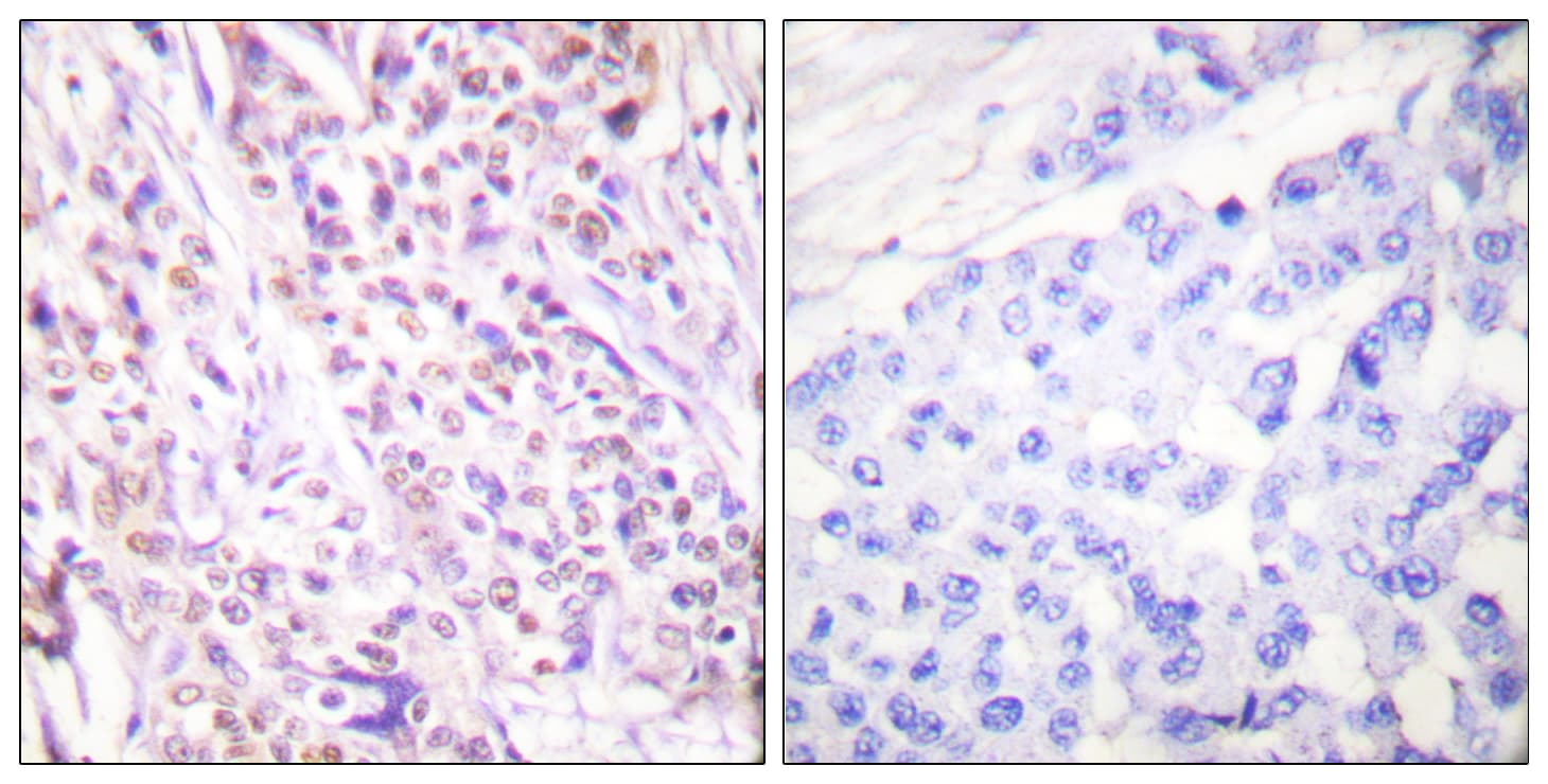 RAD17 Antibody (aa621-670)