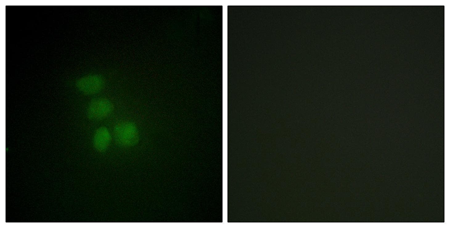 Polyclonal Rabbit anti-Human RBMX Antibody (IF, WB)