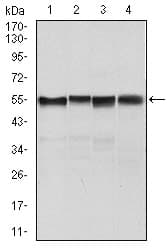 Monoclonal Mouse anti-Human SLC2A4 / GLUT-4 Antibody (clone 3G10A3, aa224-353, IHC, IF, WB)