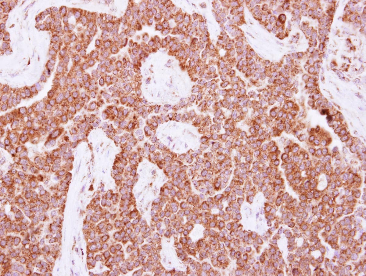 NUDT3 Antibody