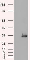 Monoclonal Mouse anti-Human SRR / Serine Racemase Antibody (clone OTI5D10, IHC, WB)