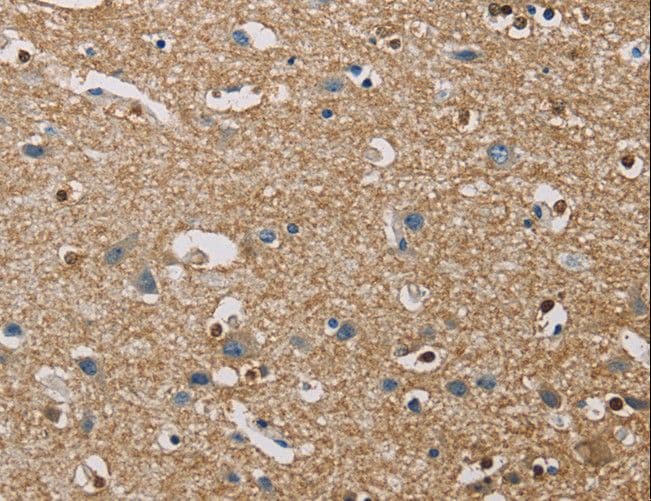 Polyclonal Rabbit anti-Human PIP4K2A / PIPK Antibody (IHC, WB)