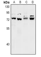 Polyclonal Rabbit anti-Human SCFD1 / SLY1 Antibody (WB)