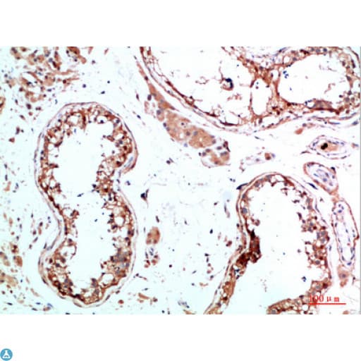 Polyclonal Rabbit anti-Human IL31 Antibody (WB)