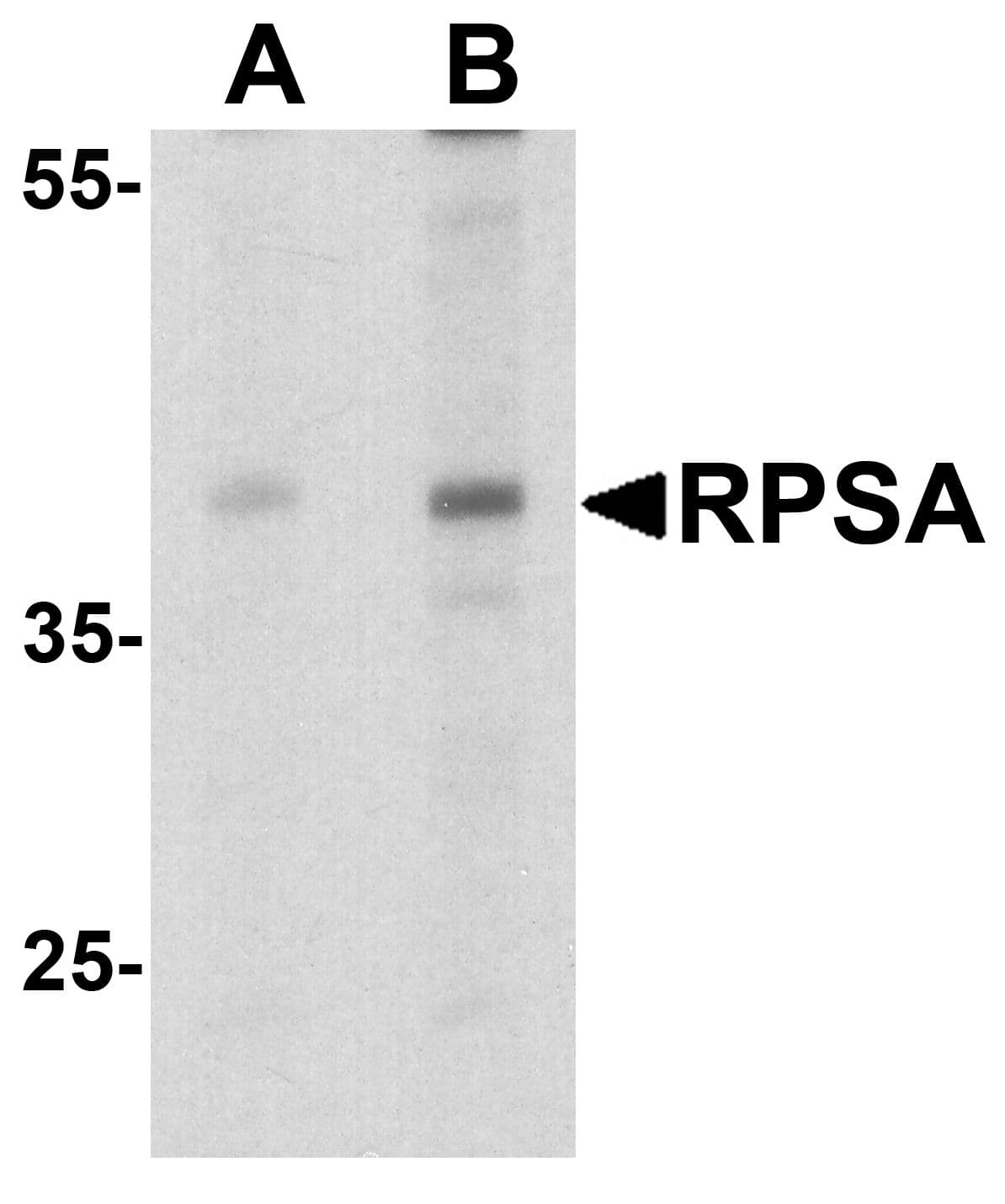 IHC-plus™ Polyclonal Rabbit anti-Human RPSA / Laminin Receptor Antibody (IHC, IF, WB)