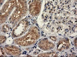 CAT / Catalase Antibody (clone OTI3C3)