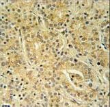 Polyclonal Rabbit anti-Human UBAC1 / KPC2 Antibody (aa264-292, IHC, WB)