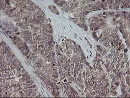 MAP2K3 / MEK3 / MKK3 Antibody (clone OTI5C7, Carrier-free)