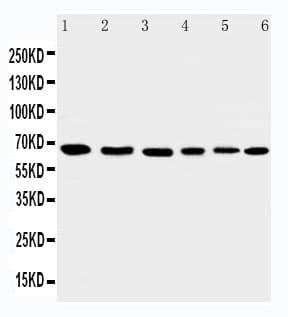 Polyclonal Rabbit anti-Human AIFM1 / AIF / PDCD8 Antibody (aa596-613, IHC, WB)