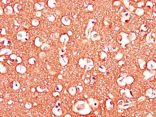 ADORA2B/Adenosine A2B Receptor Antibody