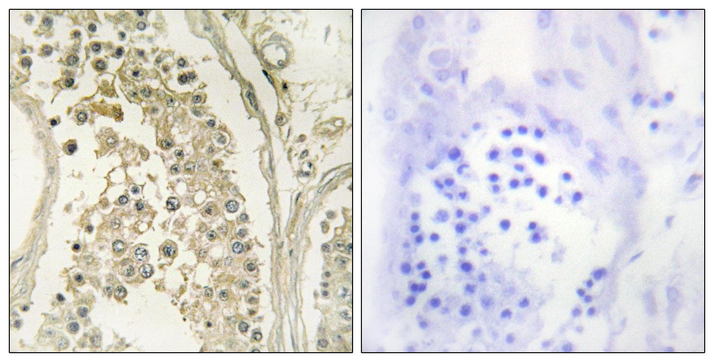 MAST4 Antibody