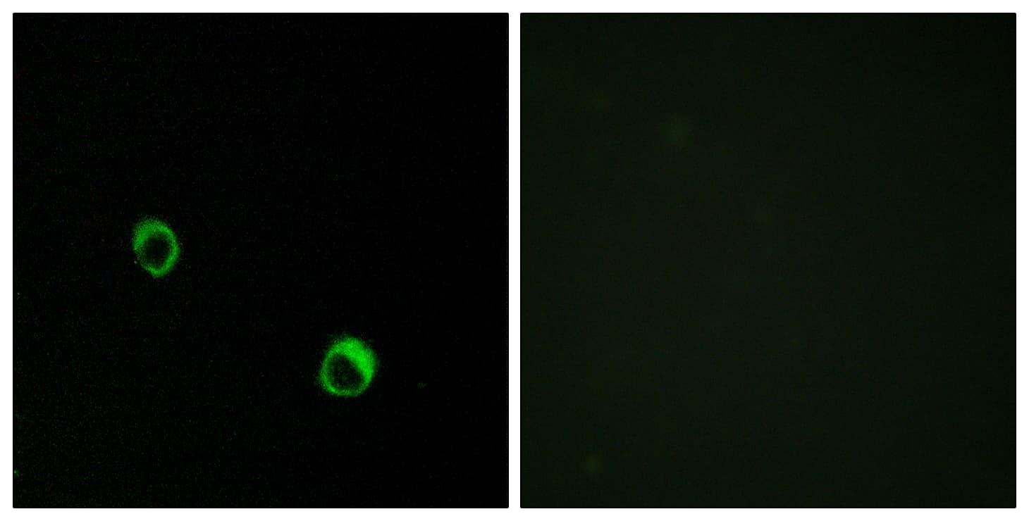 IHC-plus™ Polyclonal Rabbit anti-Human CARD14 Antibody (aa291-340, IHC, IF)