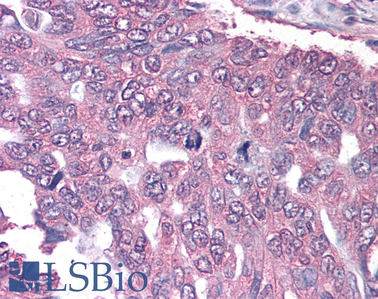 BIRC5 / Survivin Antibody (aa57-67, clone 60.11, DY488)