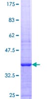 Human RECQ1 / RECQL Protein (Recombinant GST, N-terminus)