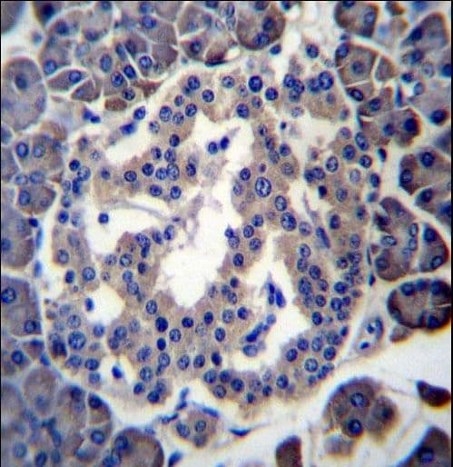 Polyclonal Rabbit anti-Human FKSG89 / MBOAT4 Antibody (aa258-287, IHC, WB)