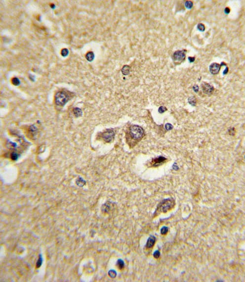 LRPAP1 Antibody (aa281-309)