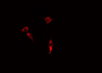 Polyclonal Rabbit anti-Human FOXC1+2 Antibody (IF, WB)