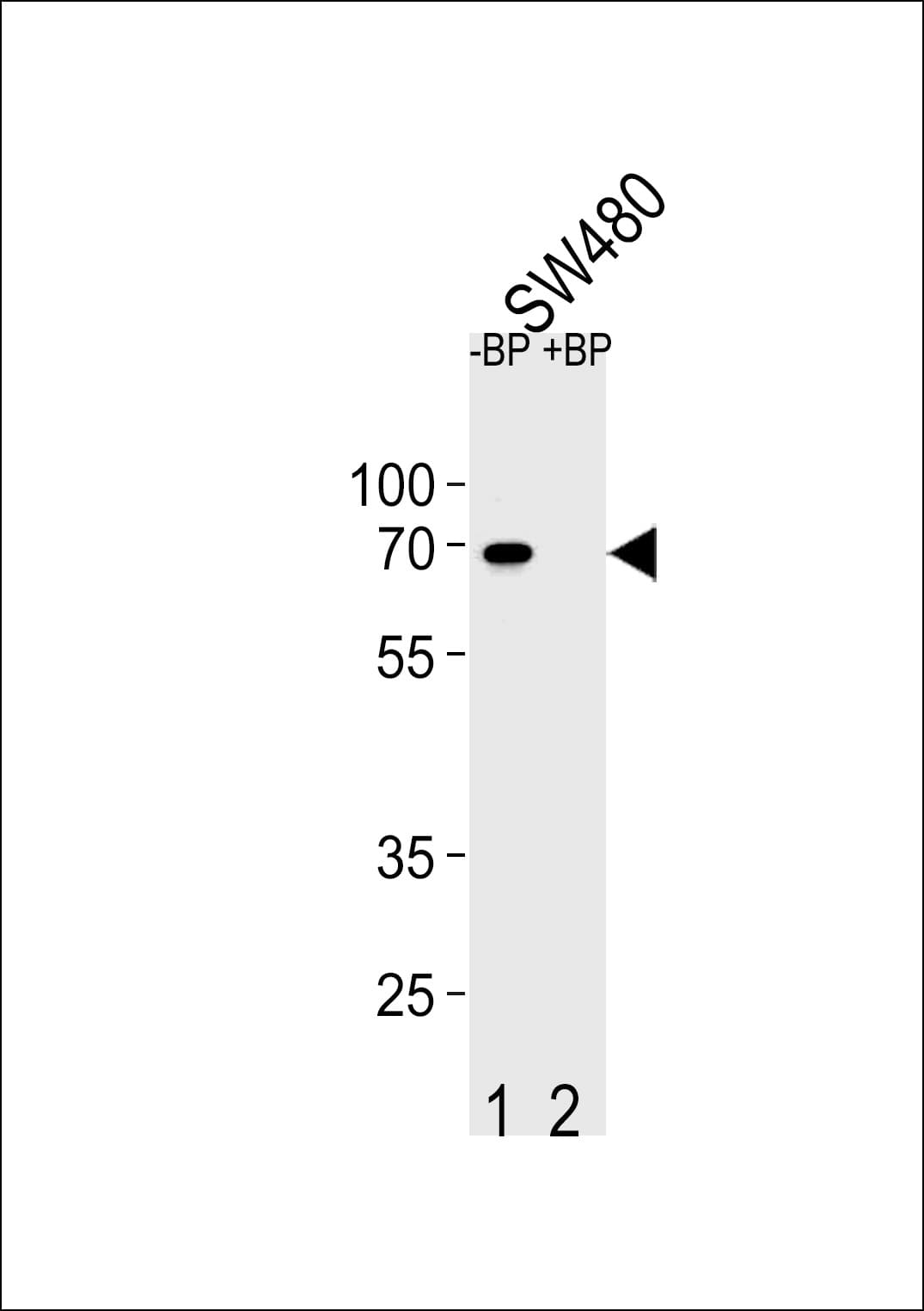 ETV5 / ERM Antibody (aa8-36)