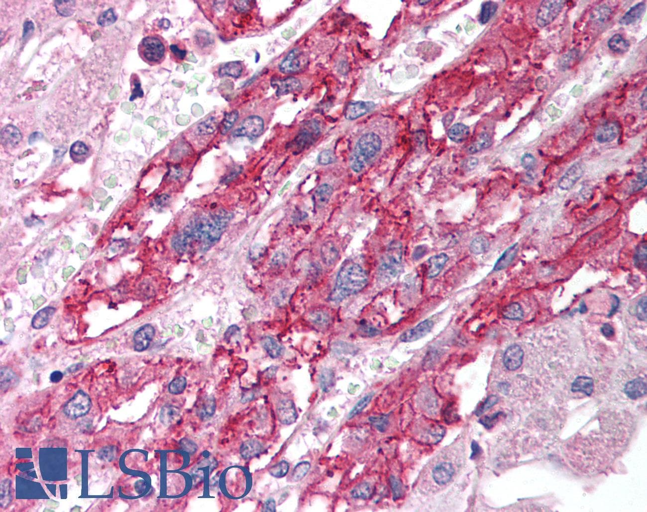 SLC18A1 / VMAT1 Antibody (aa103-152)
