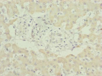 UQCC2 / MNF1 Antibody
