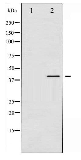 VASP Antibody (phospho-Ser157)