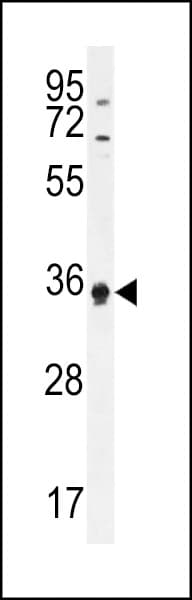 IHC-plus™ KHDC3L / ECAT1 Antibody (aa20-48)
