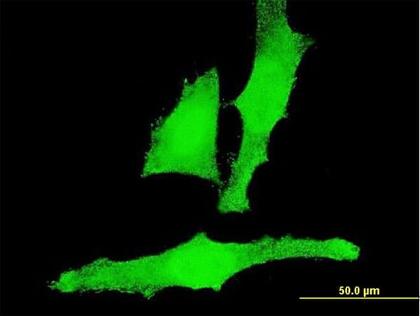 ACAN / Aggrecan Antibody (clone 2A8)