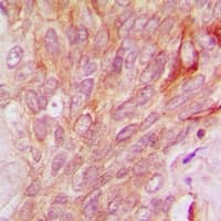 SIK3 / QSK Antibody (Internal)