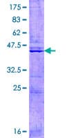 Human TIMM17A / TIM17 Protein (Recombinant GST)