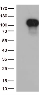 FOXO3 / FOXO3A Antibody (aa374-673, clone OTI3E6)