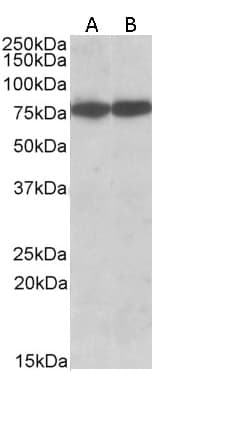IHC-plus™ HSPA8 / HSC70 Antibody (Isoform 1)