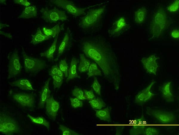 SGK1 / SGK Antibody (clone 4D7-G3)
