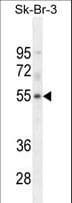 Polyclonal Rabbit anti-Human DCAF4L1 Antibody (aa241-270, WB)