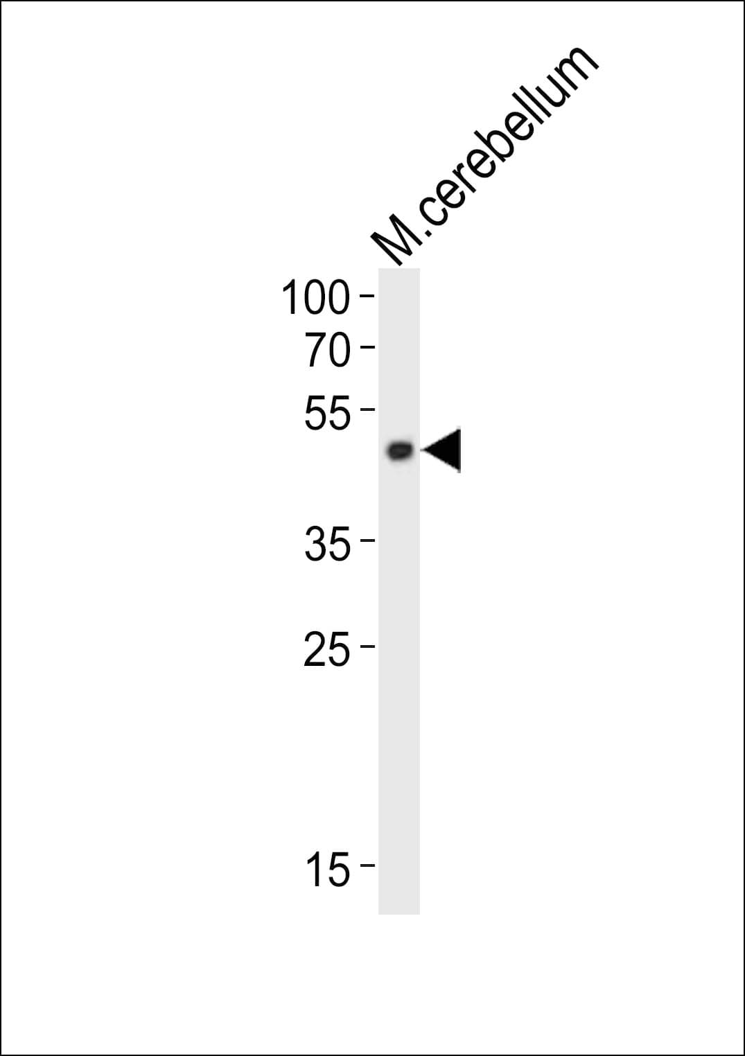 PAX6 Antibody (aa404-436)