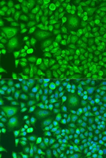 RARB / RAR Beta Antibody