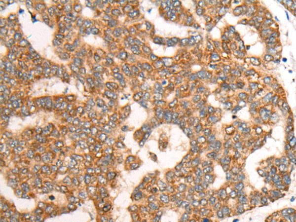 Polyclonal Rabbit anti-Human CDON / Cdo Antibody (IHC)