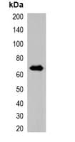 RFP Tag Antibody