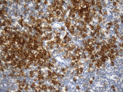 CD38 Antibody (aa43-300, clone UMAB263)