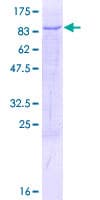 Human TBRG4 Protein (Recombinant GST)