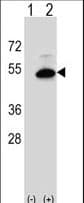 SMS2 / SGMS2 Antibody (aa338-365)
